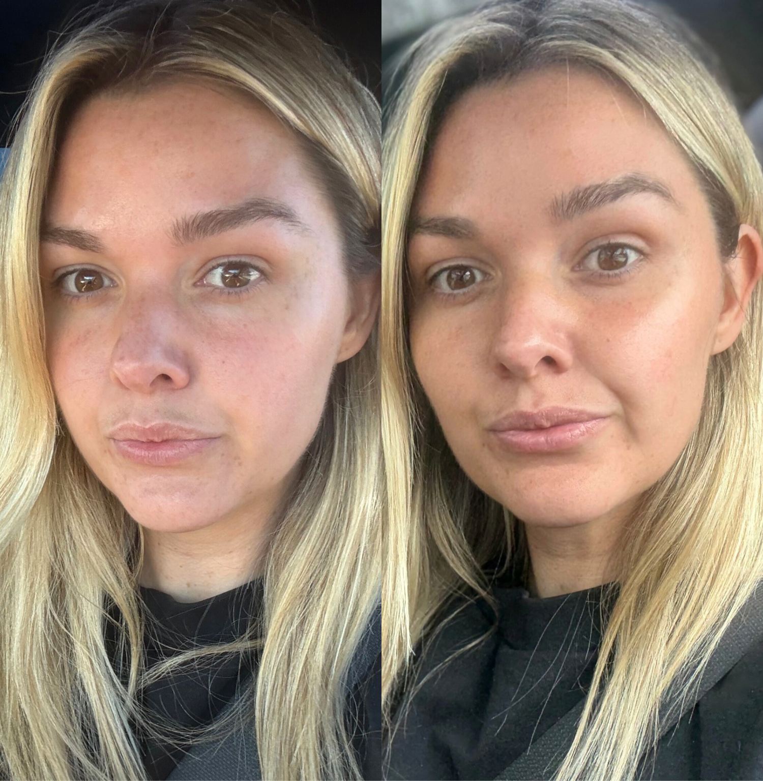 Self Tanning Glow Drops